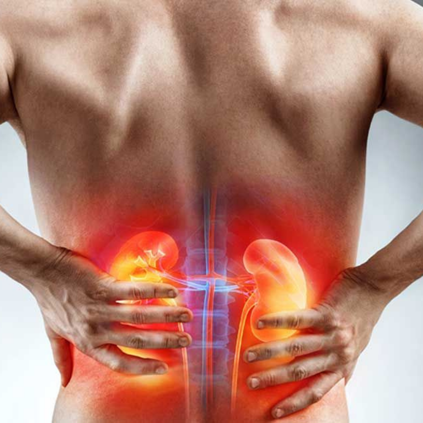 SUPLEMENTO RENAL - No sufras mas por cálculos renales